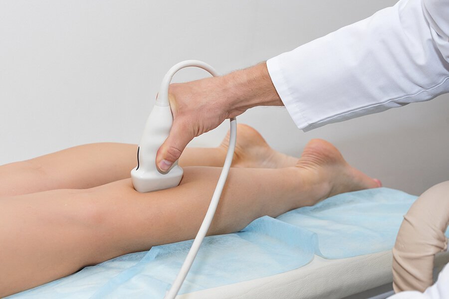 consulta-de-varices-1