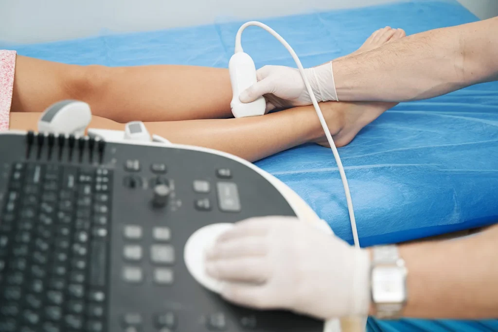 ¿Cómo se hace diagnóstico con Doppler Vascular?