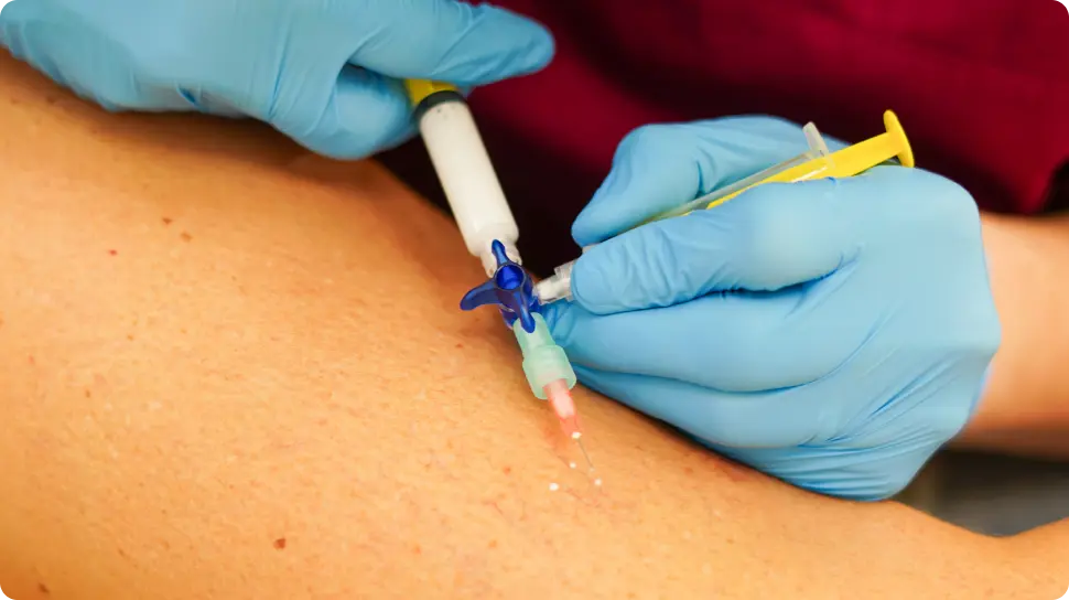 escleroterapia inyectadora imagen