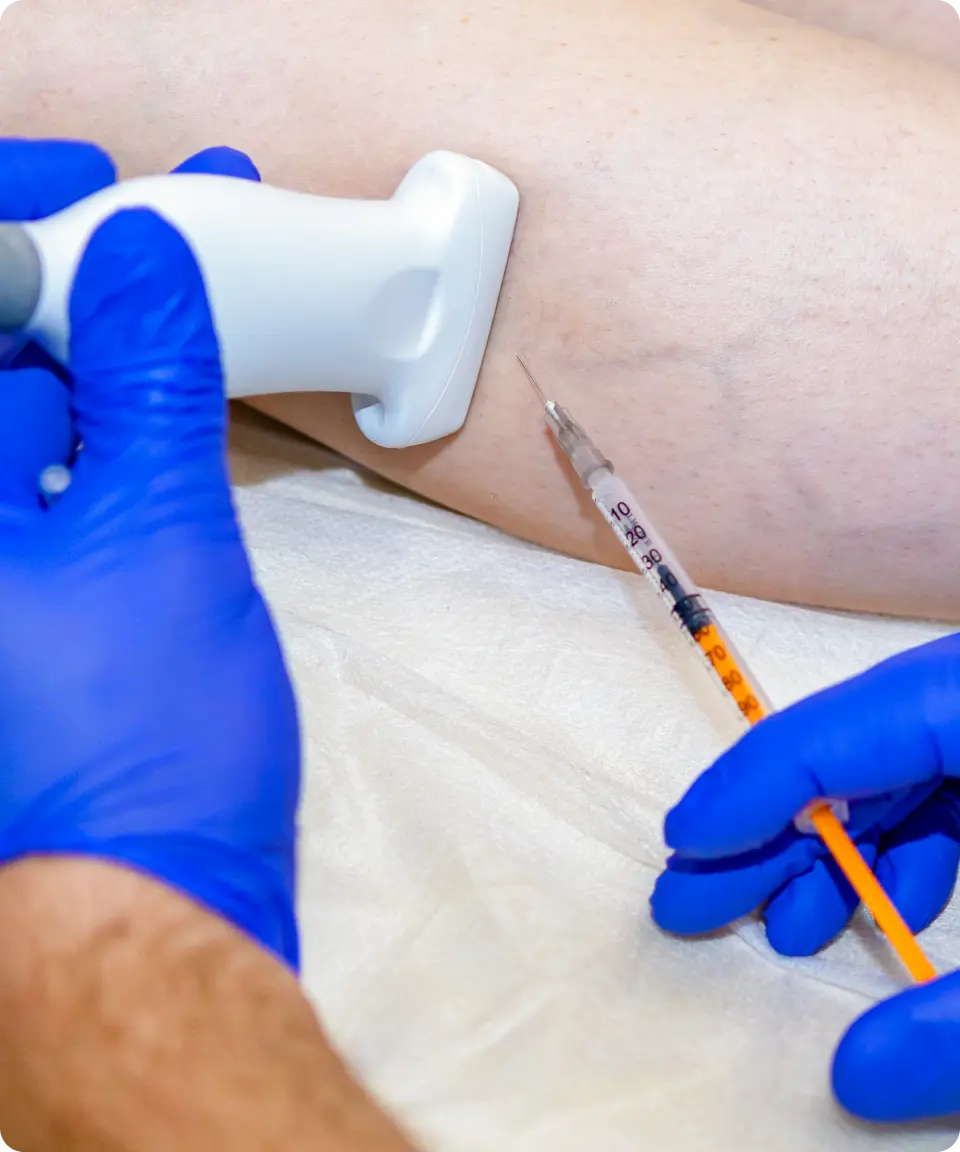 inyección con doppler en venas