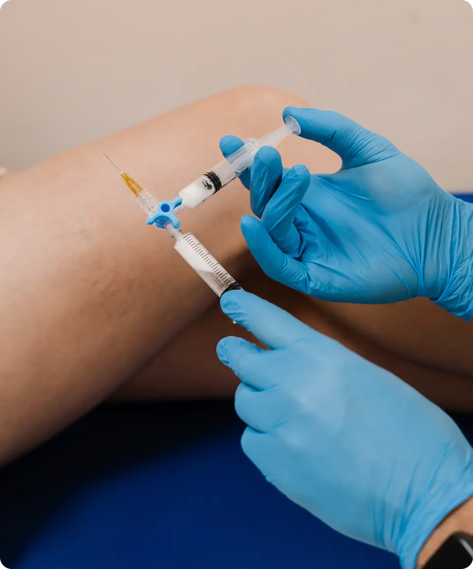 inyección de espuma para venas