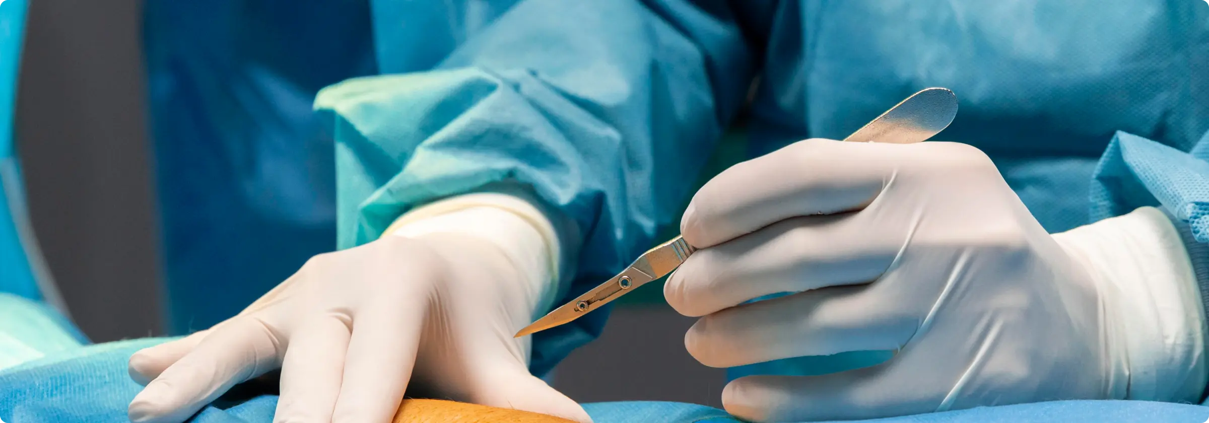 radiofrecuencia imagen